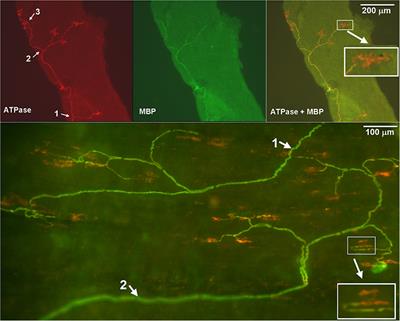 Slowly Adapting Sensory Units Have More Receptors in Large Airways than in Small Airways in Rabbits